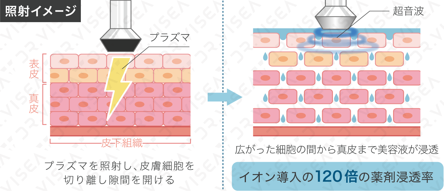 プラズマシャワーの効果とは？ | 渋谷区恵比寿のエステ flur – 恵比寿 